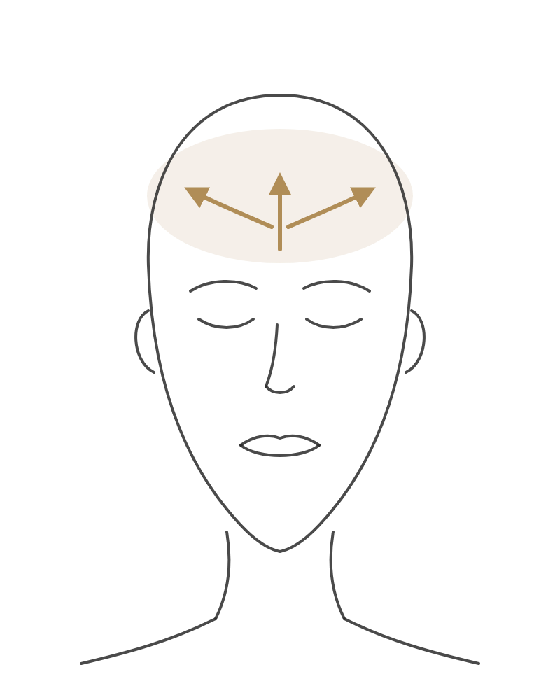 The Forehead technique diagram