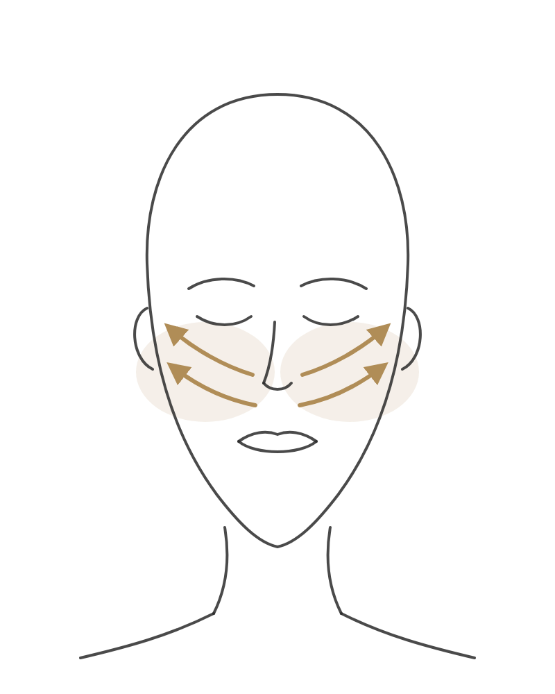 The Cheeks technique diagram